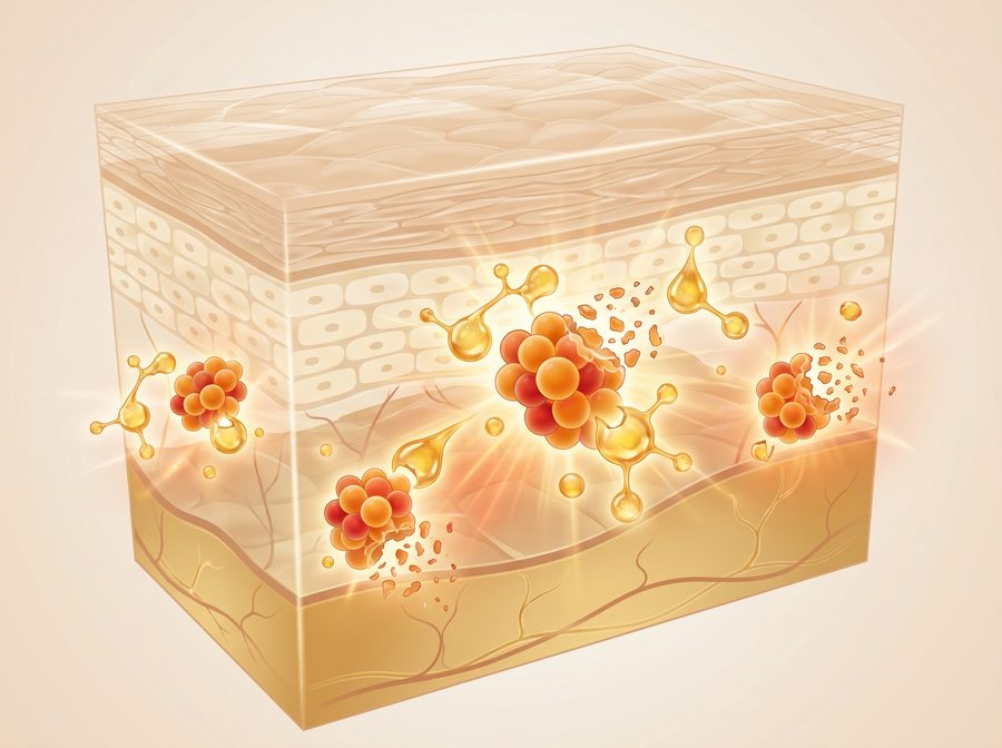 Manuka Honey kills Staph aureus bacteria