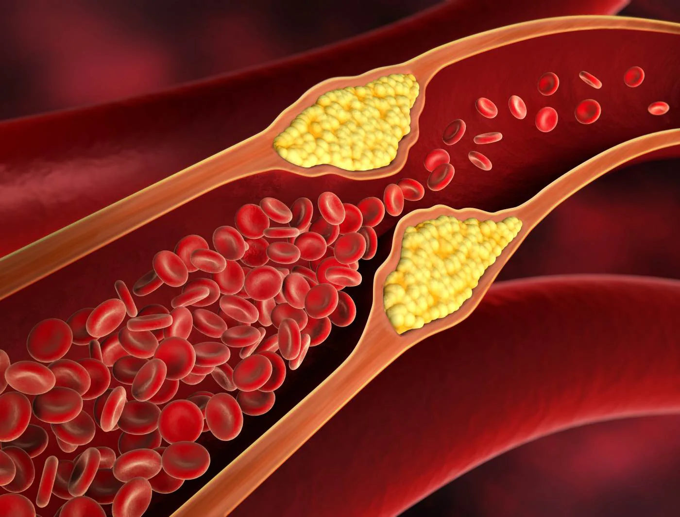 high-cholesterol-can-affect-fertility__PID:83a56063-a2d0-422d-930f-413ca234284d